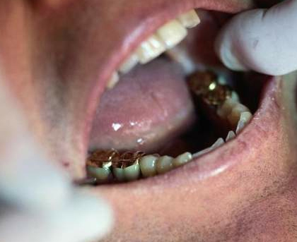 Dental Services in Costa Rica