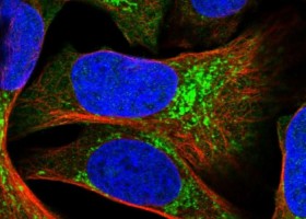 Subcell of TBC1D16. More images available at proteinatlas.com
