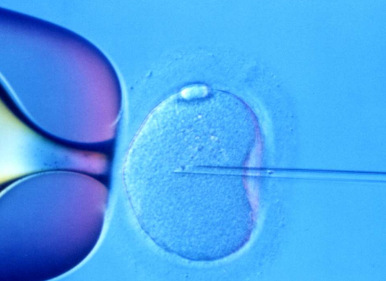Costa Rica in-vitro fertilization law Costa Rica in-vitro fertilization law