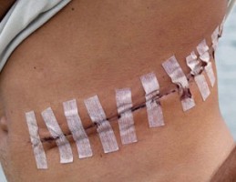 Costa Rica Organ Trafficking Ring
