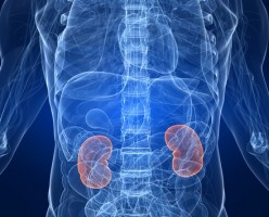 Kidney Failure in Guanacaste