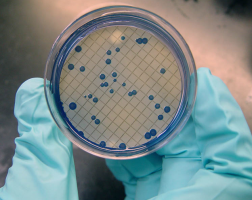 Fecal Coliforms Costa Rica
