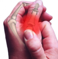 Osteoarthritis Recovery in Guanacaste Costa Rica