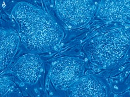 stem cells